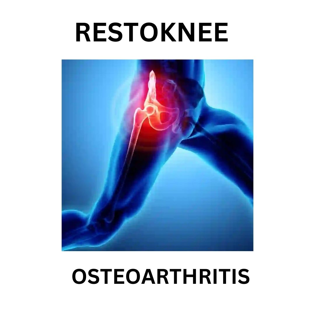 Osteoarthritis
